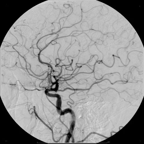CT Angiography at Kansal Diagnostic Centre, Amritsar