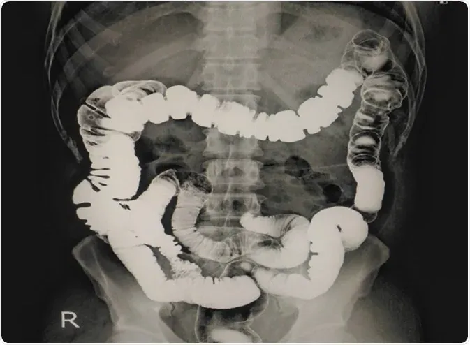 Fluoroscopy & Contrast Studies at Kansal Diagnostic Centre, Amritsar